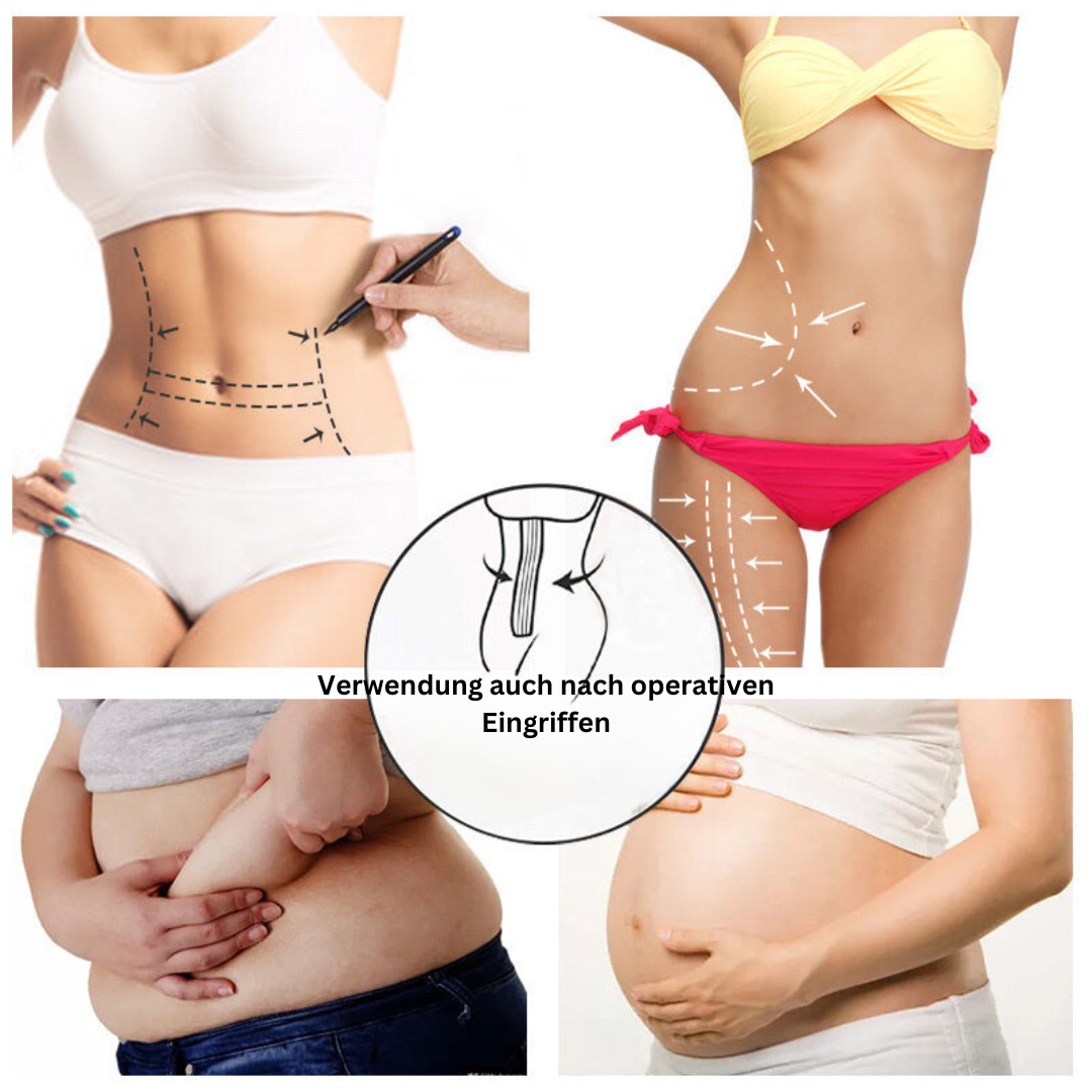 ShapeUp Bodysuit Sculpting